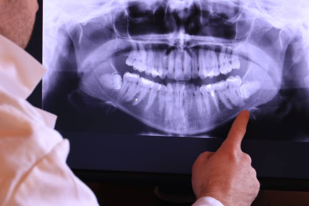 Best Emergency Tooth Extraction in Hooverson Heights, WV
