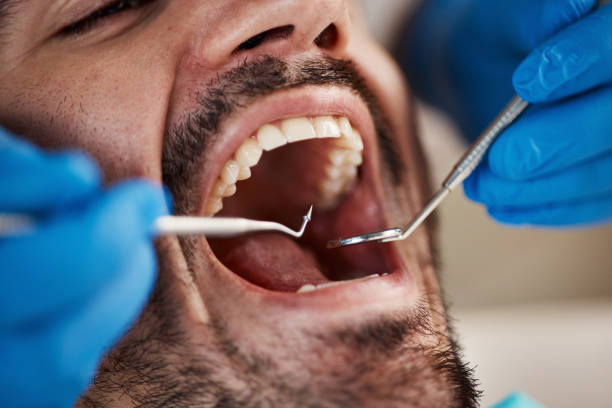 Best Same-Day Emergency Dental Services in Hooverson Heights, WV