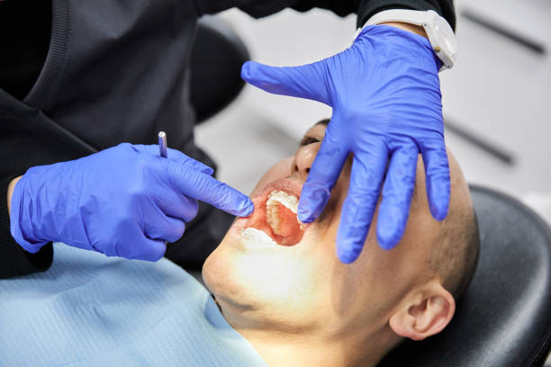 Best Emergency Root Canal Treatment in Hooverson Heights, WV