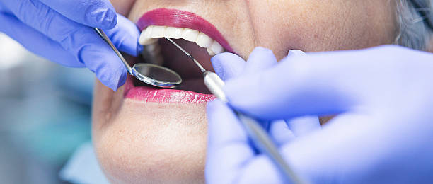 Best Emergency Wisdom Teeth Removal in Hooverson Heights, WV